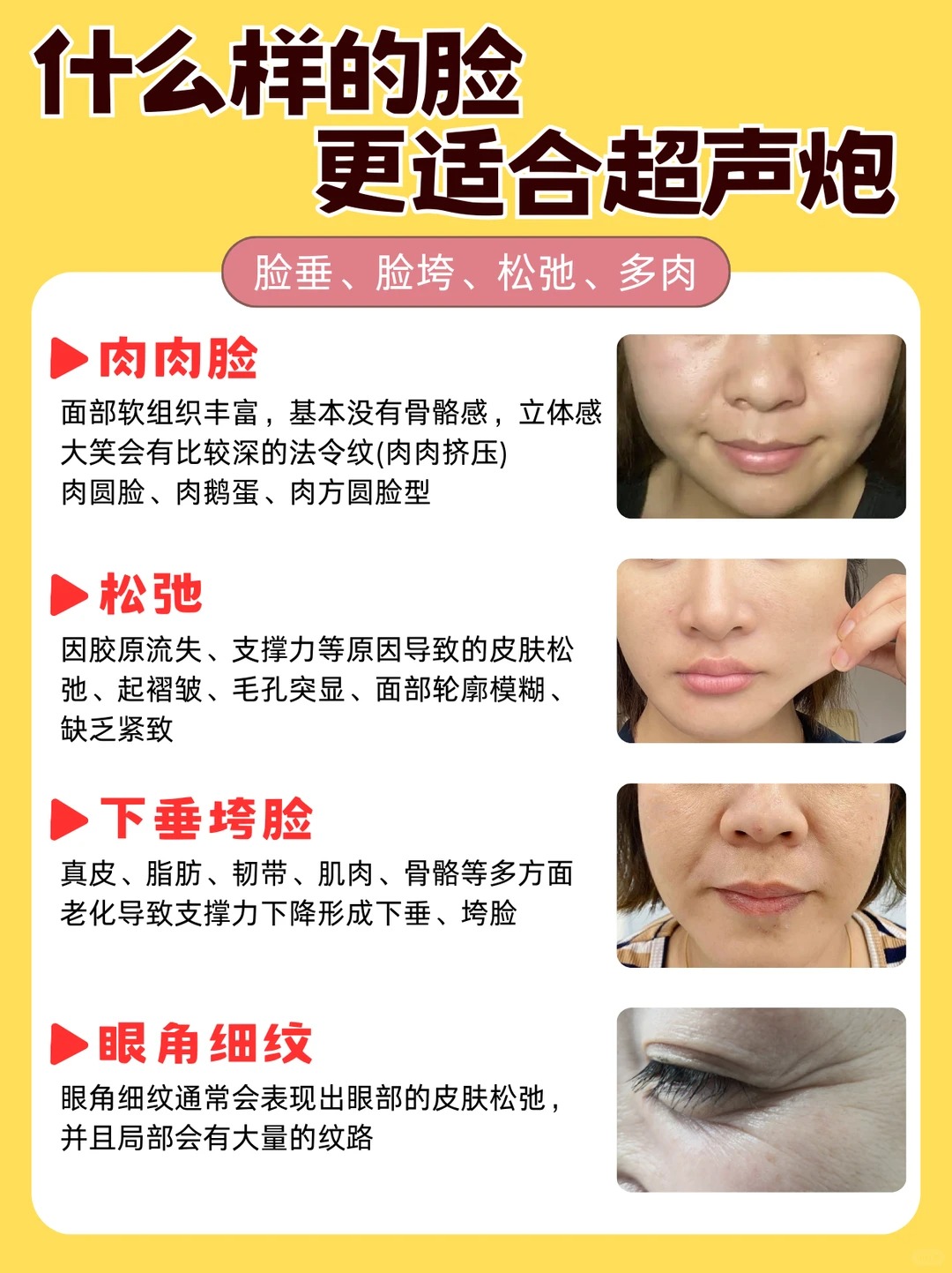 半岛超声炮适应症
