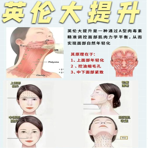 英伦大提升原理