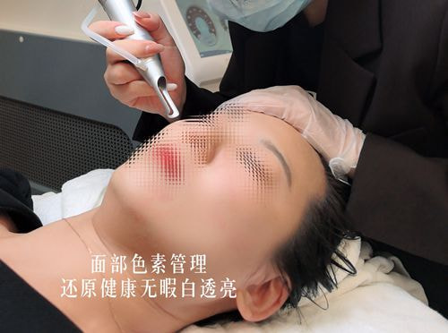 朱紫婷医生擅长项目