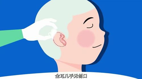 耳朵整形6.jpg