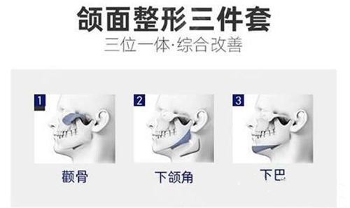 磨骨三件套.jpg