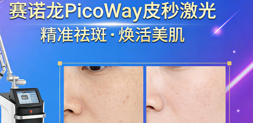 赛诺龙PicoWay皮秒激光