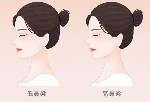 鼻子.jpg