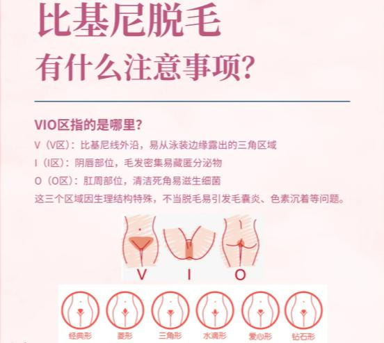 比基尼冰点脱毛.jpg