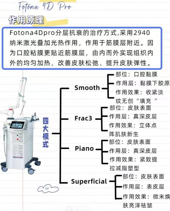 欧洲之星Fotona4D.jpg