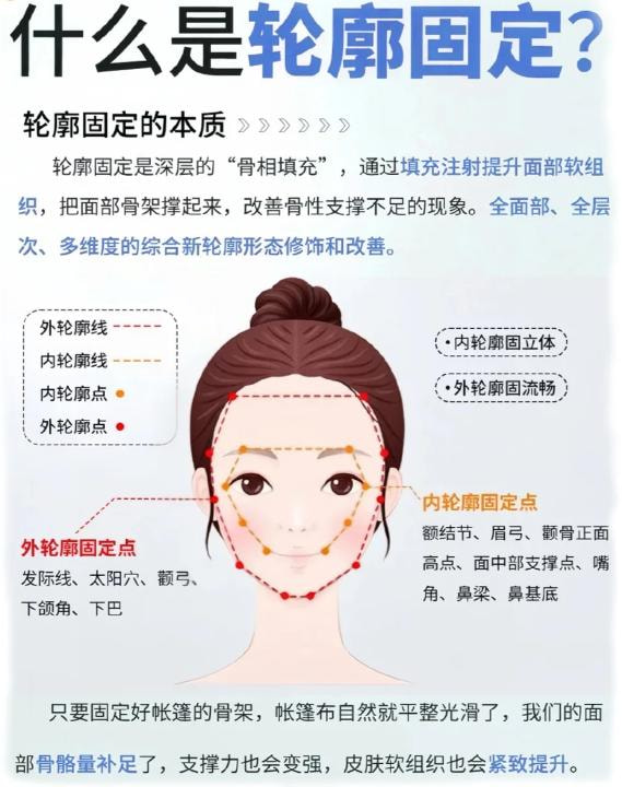 轮廓固定.jpg
