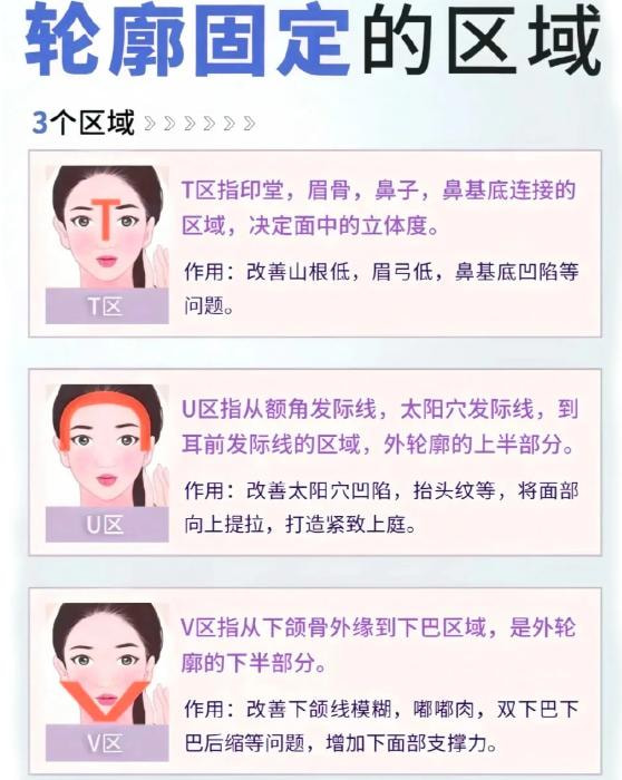 轮廓固定2.jpg