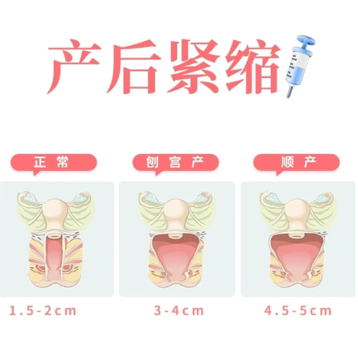 注射紧缩针.png