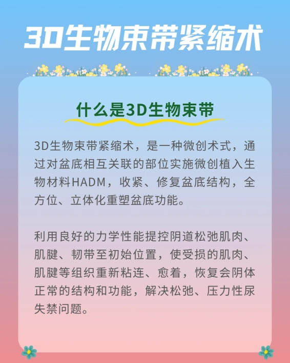 3d生物束带紧缩术.png