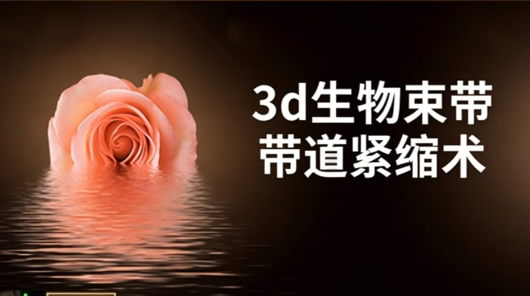 3d生物束带紧缩术