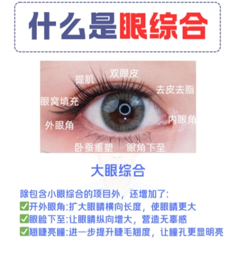 大眼综合.png