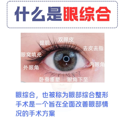 眼综合手术.png