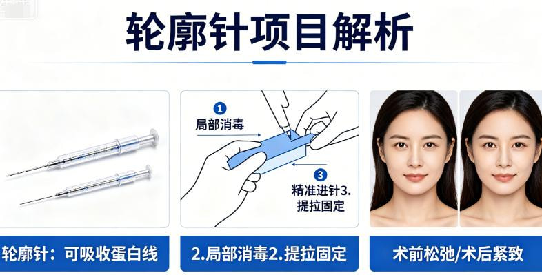 轮廓.jpg