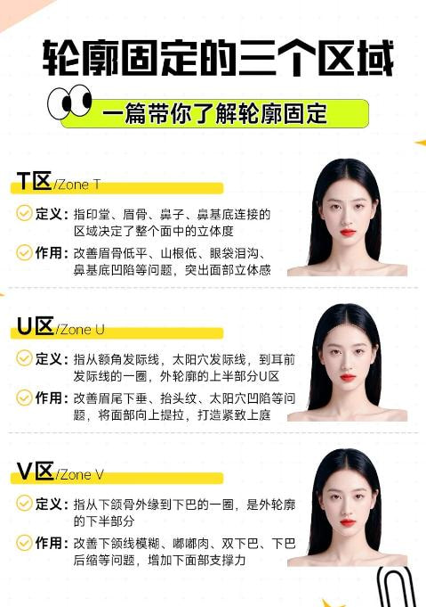 轮廓注射4.jpg