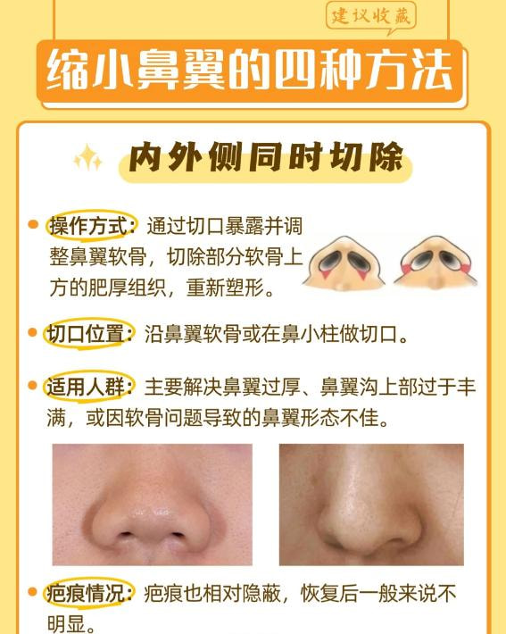 鼻头缩小3.jpg