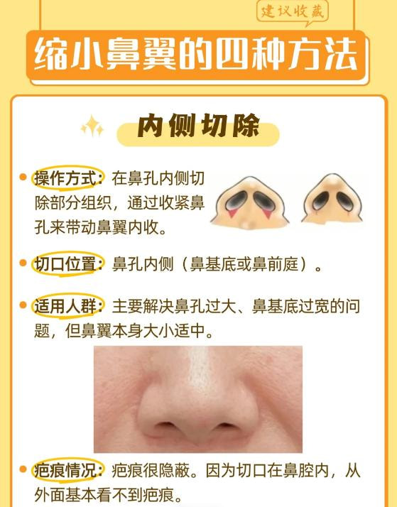 鼻头缩小1.jpg