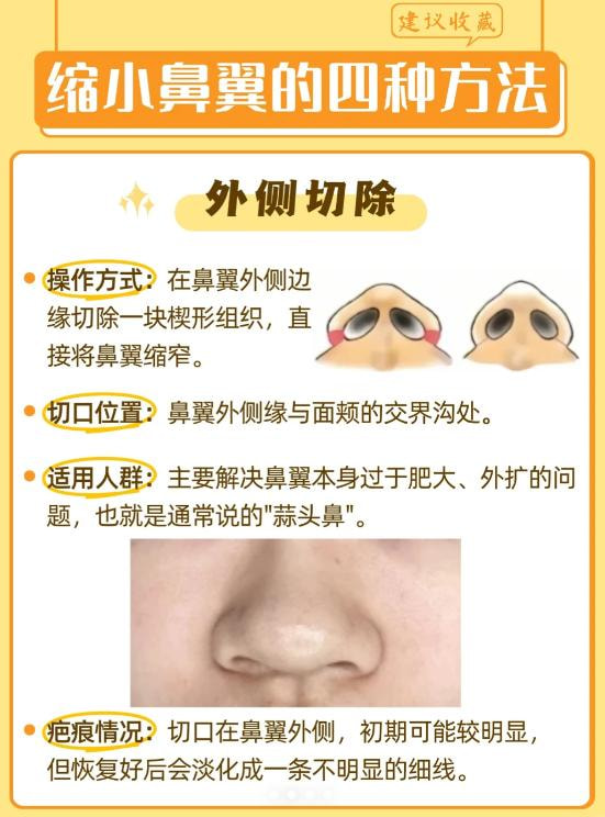 鼻头缩小2.jpg
