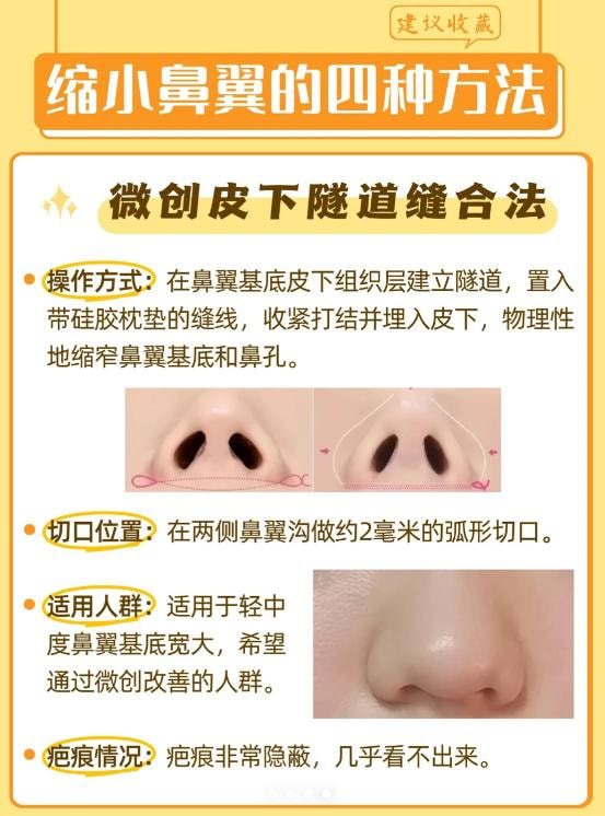 鼻头缩小4.jpg