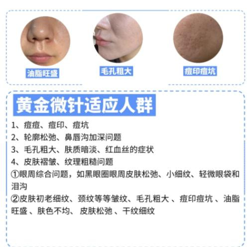 黄金微针2.jpg