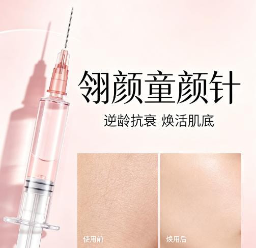 翎颜童颜针