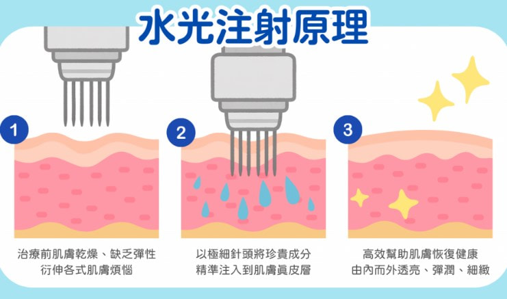 菲欧曼 135HA 填充针