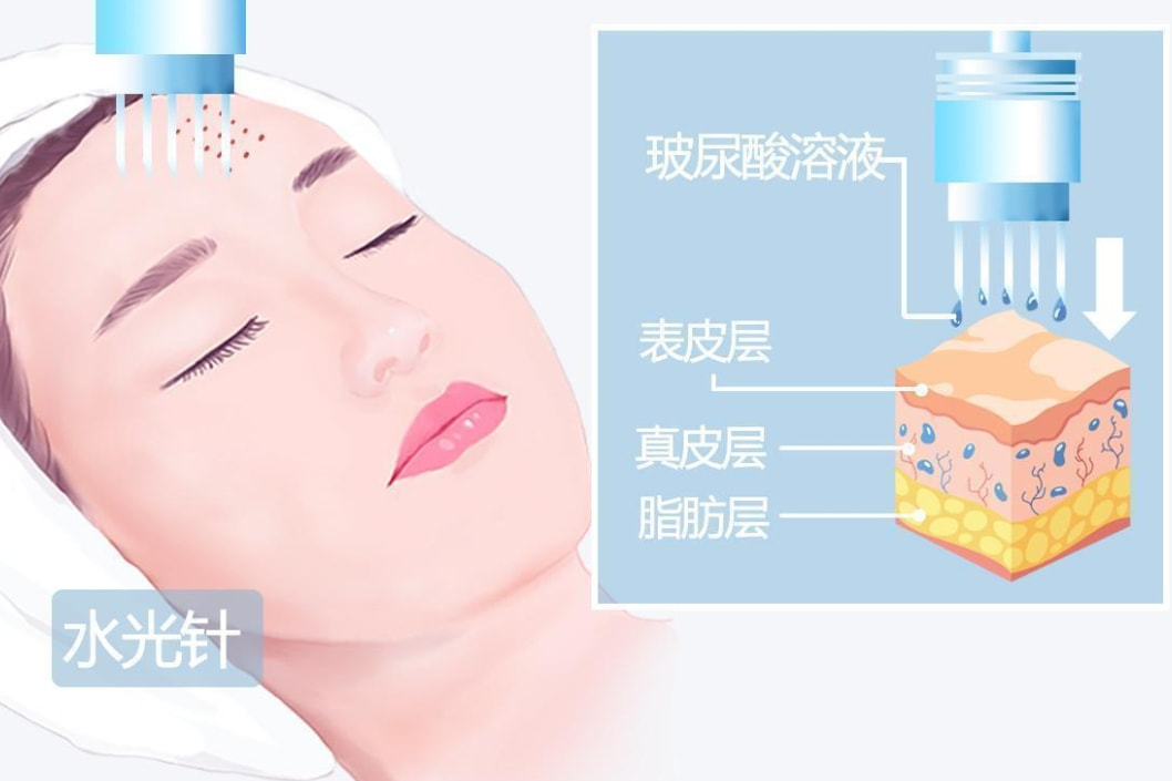 菲欧曼