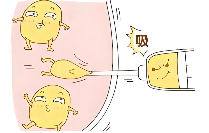 单部位面部吸脂