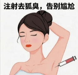 国产去腋臭100单位 正品可验