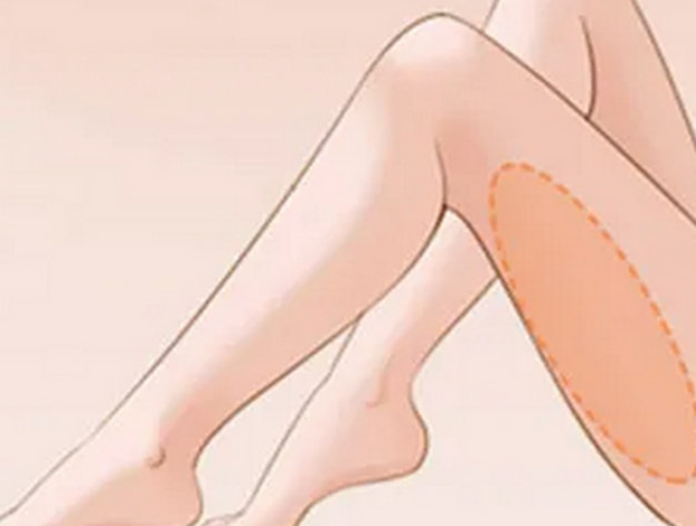 大腿单部位环吸