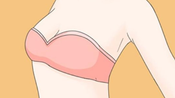 脂肪丰胸5.png