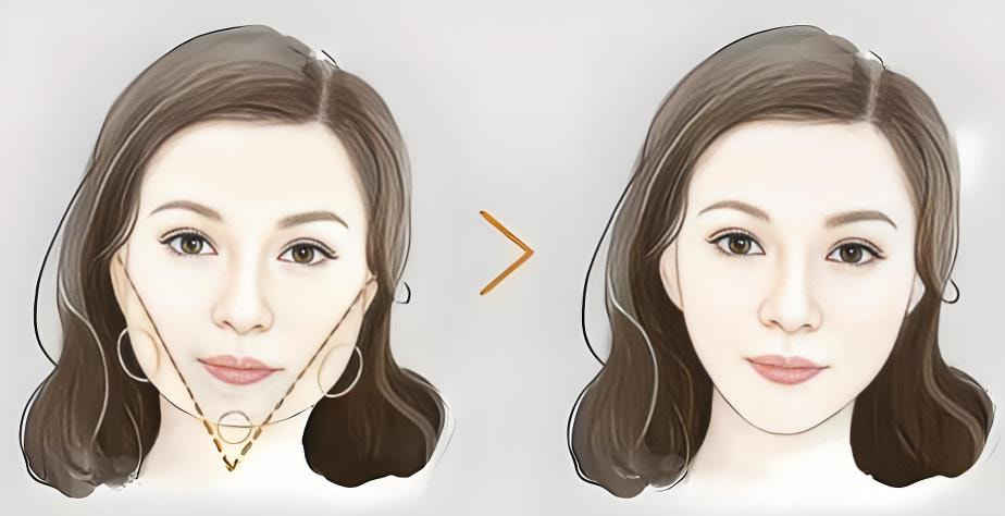 磨骨瘦脸5.jpg