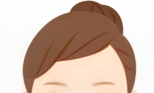 额头馒化修复