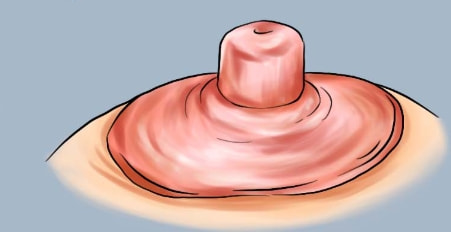 乳晕敏感激活(含嫩红)