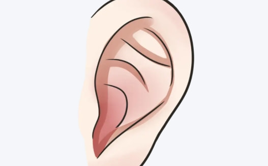 附耳切除
