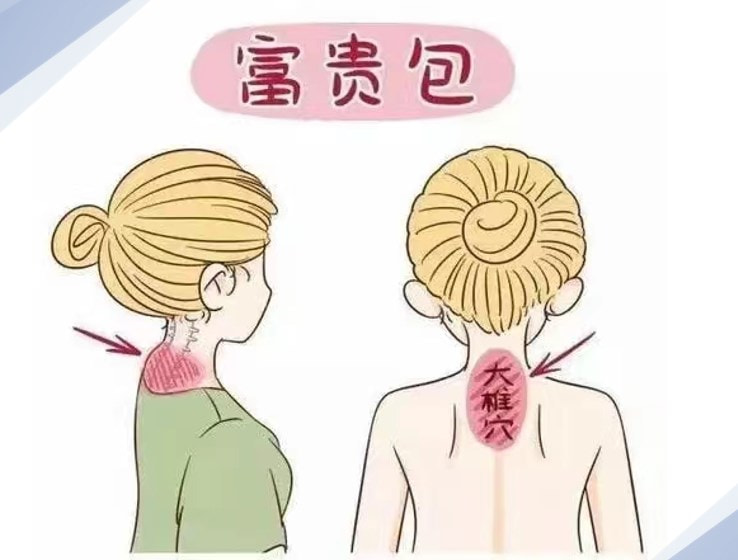 富贵包图片.jpg