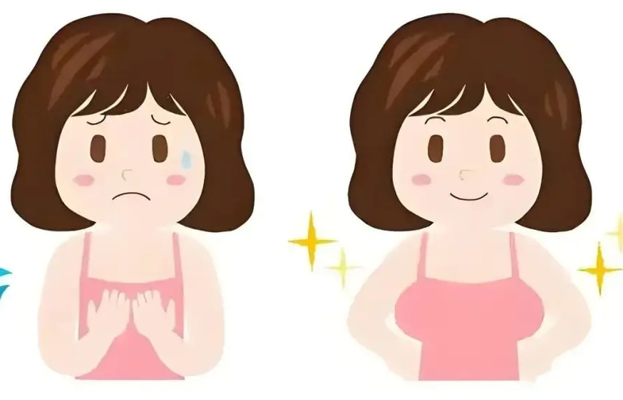 脂肪丰胸1.png