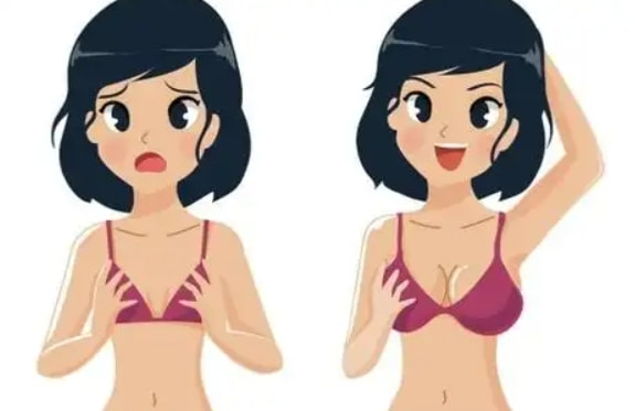脂肪丰胸4.png