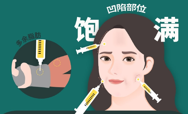 脂肪填充5.png