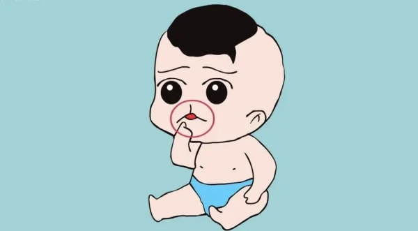 唇裂修复.jpg