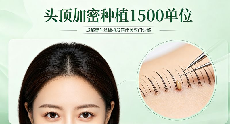 头顶加密2.jpg