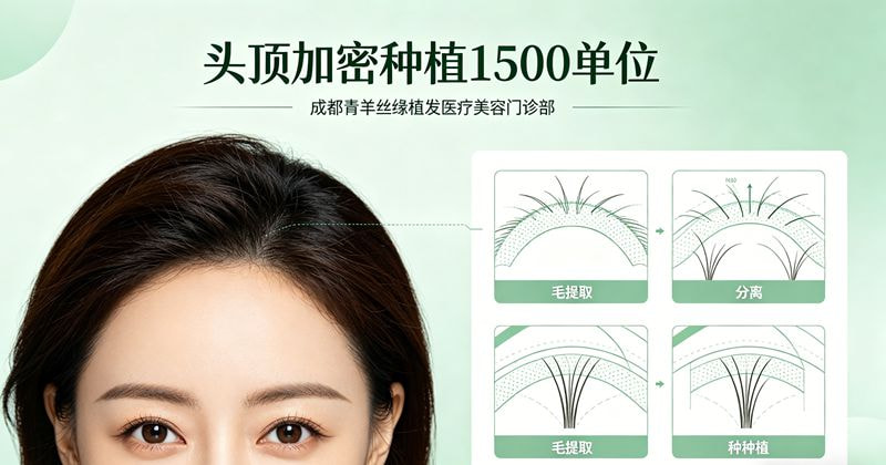 头顶加密种植1500单位