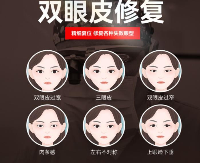 双眼皮修复4.jpg