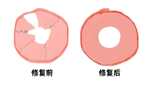 处女膜修复咨询领券 私密诊疗