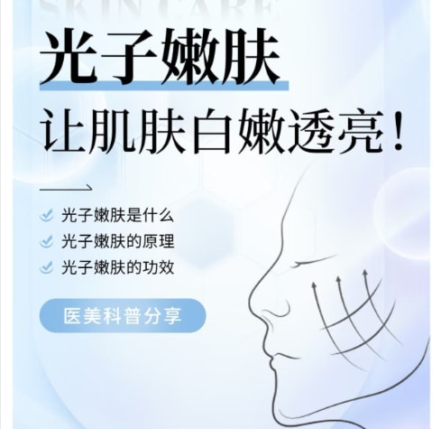 光子嫩肤.png