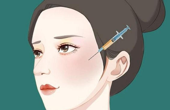 脂肪精雕