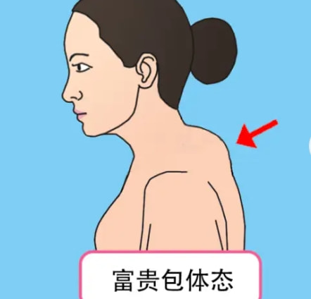 水刀富贵包消容术,高山院长