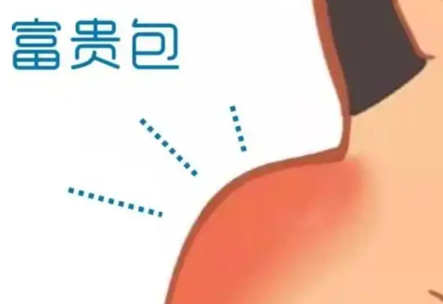 水刀富贵包消容术,高山院长
