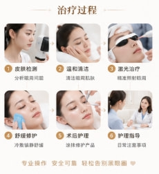 激光去黑眼圈