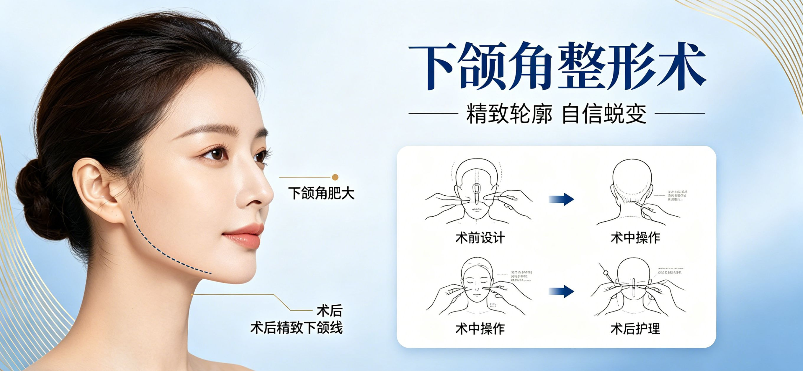 下颌角磨骨