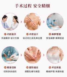 巨乳缩小整形